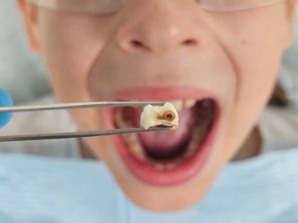 Best Emergency Dental Care for Trauma or Injury in Cherry Valley, IL